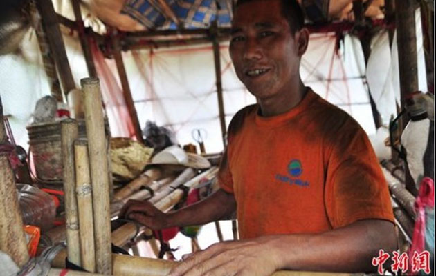 Liu Linchao, el "hombre caracol" foto: ChinaNews.com