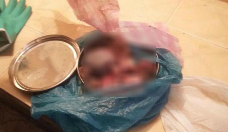 El caso del feto abandonado en el baño de la reconocida feria de La Chorrera, en el 2016, escandalizó a la población, ya que se encontraba dentro de una lata de galletas y dejado en este lugar. Feria de La Chorrera: El caso del feto abandonado en el baño de la reconocida feria de La Chorrera, en el 2016, escandalizó a la población, ya que se encontraba dentro de una lata de galletas y dejado en este lugar.