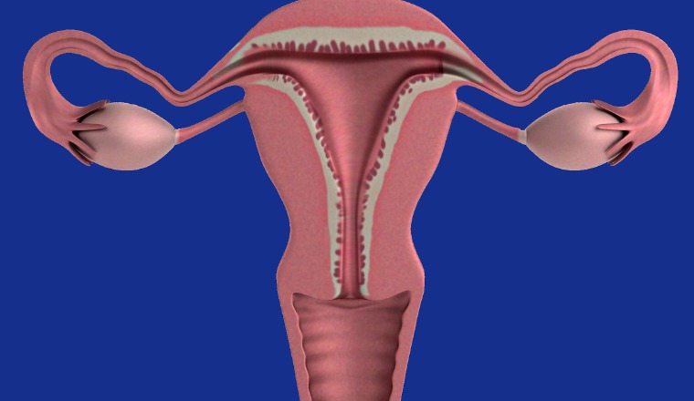 Afección del cuello uterino. Afección del cuello uterino.