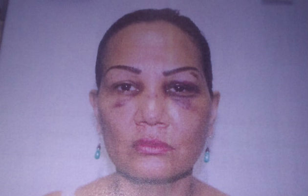 Lorenza Batista asegura que ha sufrido maltrato por su expareja. Foto: Melquíades Vásquez. 