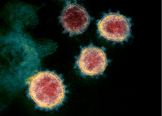 Coronavirus: Trump anticipa dos semanas muy dolorosas en EE.UU. con más de 100.000 muertos por COVID-19 Los contagios por coronavirus en EE.UU. superan ya los 188.000 casos. Foto: Archivo/Ilustrativa.