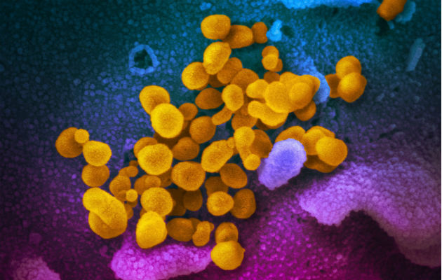 La OMS confirma más de un millón de casos de coronavirus en el mundo Más de 50.000 muertes por el COVID-19 se han registrado hasta la fecha en el mundo. Fotos: Archivo/Ilustrativa.