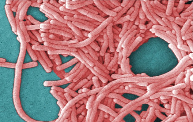 Una imagen de un microscopio electrónico de barrido coloreada de manera digital proporcionada por Janice Haney Carr/Centros para el Control y la Prevención de Enfermedades muestra la Legionella pneumophila, la bacteria que causa la enfermedad del legionario. (Janice Haney Carr/Centros para el Control y la Prevención de Enfermedades vía The New York Times).