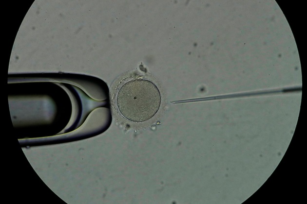 Personal técnico trabaja con espermatozoides en el laboratorio de la clínica Panama Fertility. Foto: EFE Personal técnico trabaja con espermatozoides en el laboratorio de la clínica Panama Fertility. Foto: EFE