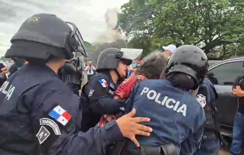 Extraoficialmente hay tres personas detenidas uno de ellos paciente y dos del Suntracs. Foto. Thays Domínguez Extraoficialmente hay tres personas detenidas uno de ellos paciente y dos del Suntracs. Foto. Thays Domínguez