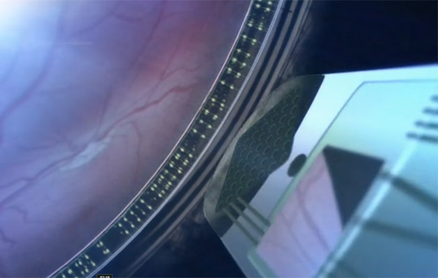 Captura de video de Pixium que explica su tecnología, aquí se muestra al chip insertado
