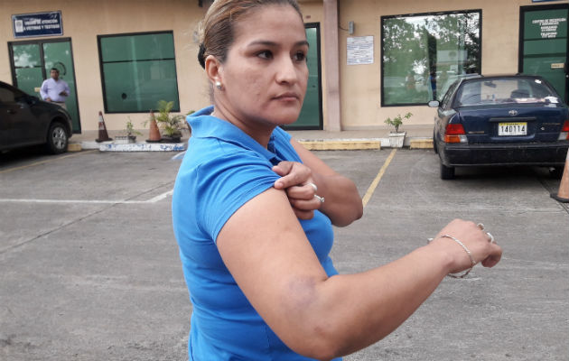 La otra mujer fue golpeada en el brazo por policías en Chiriquí. La otra mujer fue golpeada en el brazo por policías en Chiriquí.