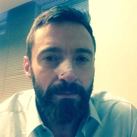 Hugh Jackman fue operado de nuevo por un cáncer de piel