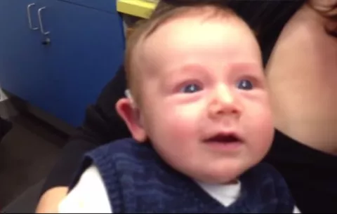 Reacción de bebé con nuevo implante auditivo captura la atención por YouTube
