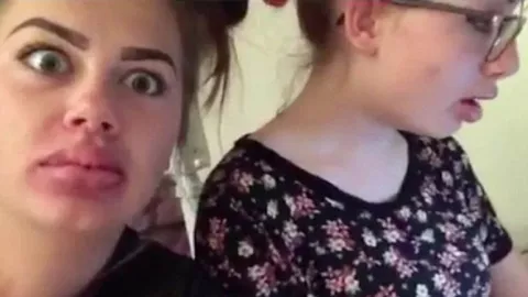 Jóvenes succionan sus labios para el "desafío Kylie Jenner"