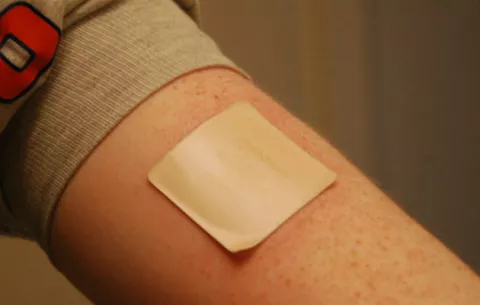 Parche de insulina  podría sustituir las inyecciones