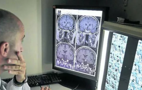 Estudio: Dormir mejor podría proteger contra el Alzheimer 