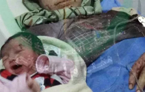 En Siria nace bebé con golpe de metralleta