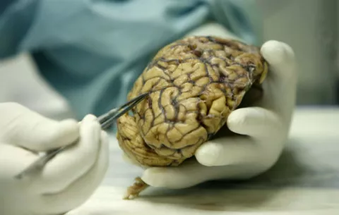 ¿Cree usted que el cerebro de las personas inteligentes funciona diferente?
