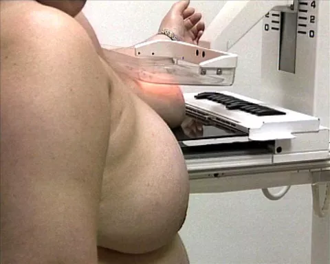 Coordinación y seguimiento, déficits en asistencia del cáncer de mama