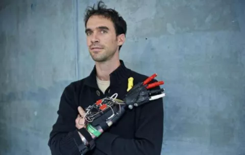 Discapacitado se fabrica su propia mano en una impresora 3D
