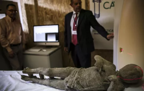 Los pompeyanos de hace 2,000 años tenían dientes perfectos por comer sano
