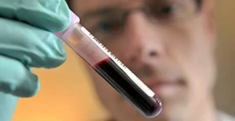 Un análisis de sangre puede descartar ataques cardíacos en urgencias