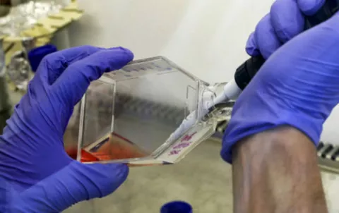 Nueva tecnología hace que las células cancerosas 'se asesinen'
