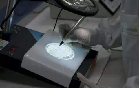 Cáncer transmitido por lombriz abre puertas a la ciencia