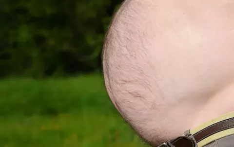 Grasa abdominal, perjudicial para tu salud aunque tengas un peso normal