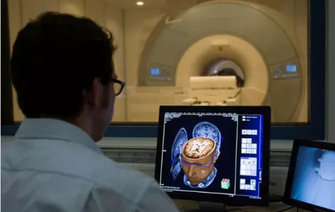 Descubren en Taiwán un método para un diagnóstico más preciso del Parkinson