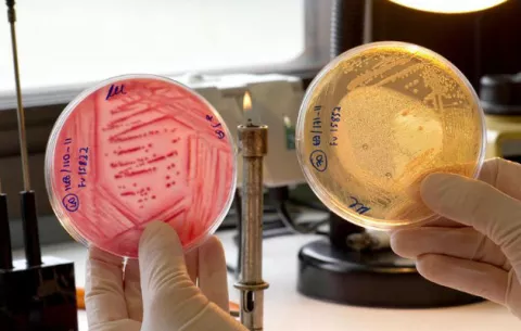La bacteria E.coli puede causar infecciones urinarias, según un estudio