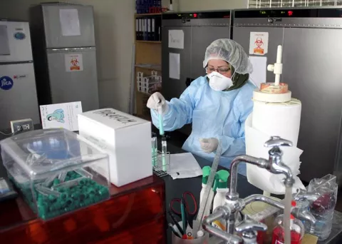 Un test podría reducir las muertes por tuberculosis en pacientes con VIH