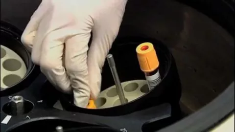 Diseñan en México dispositivo que detecta cáncer de mama a través de saliva