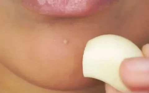 Frotarse ajo para eliminar los granitos, la tendencia de belleza que es furor en Instagram