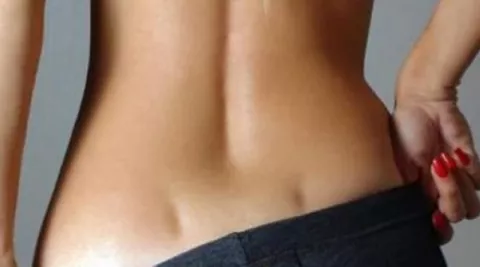 ¿Qué significa los hoyuelos en la espalda?