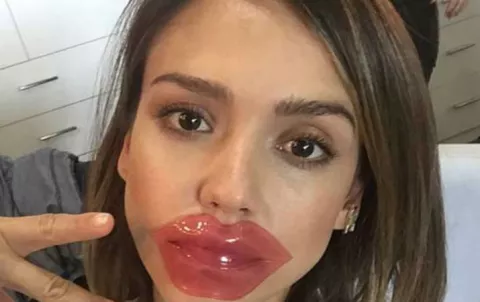 Parches labiales: la tendencia de belleza de las famosas