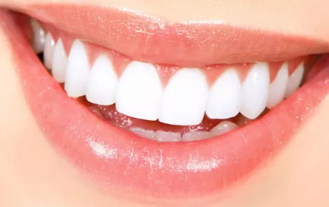 Alternativas para blanquear tus dientes desde casa