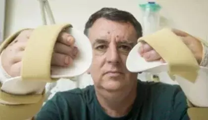 Médicos hacen el primer trasplante de manos en Reino Unido