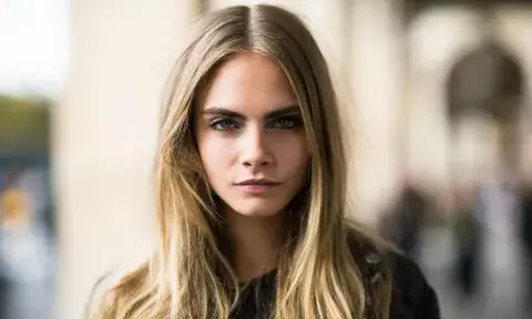 Cara Delevingne sufre de psoriasis