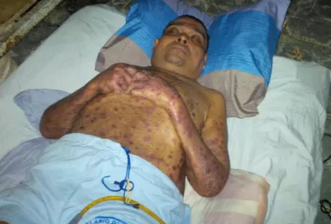 Piden casa por cárcel para reo enfermo en Colón