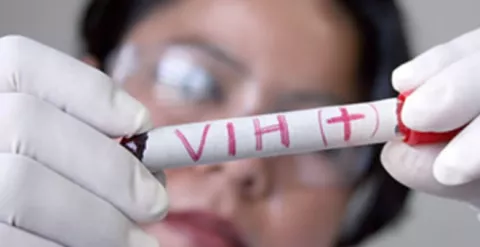 Hallan variante genética que bloquea entrada del VIH al organismo