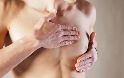 Cáncer de mama en hombres