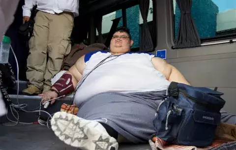 El hombre más obeso del mundo, listo para bajar de peso