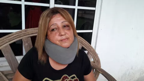 Docente es golpeada brutalmente por madre de familia en Veraguas