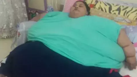 La "mujer más gorda de mundo" será operada en la India