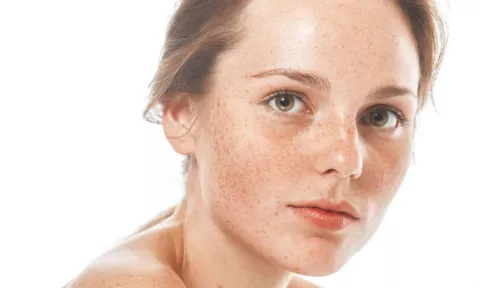 Pecas falsas, la moda que busca resaltar los ojos