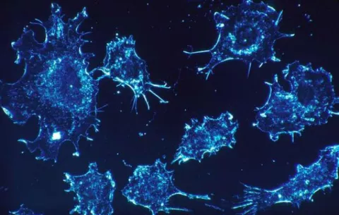Mortalidad del cáncer en EE.UU. se reduce un 25%