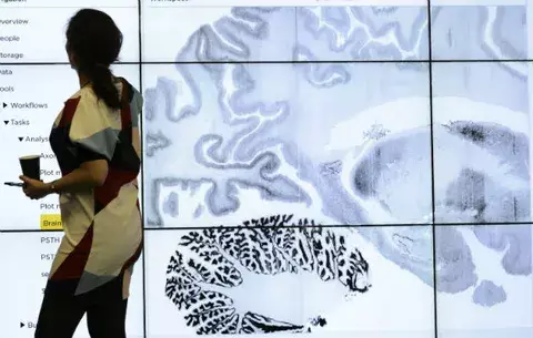 Una parte del cerebro sigue creciendo durante la edad adulta