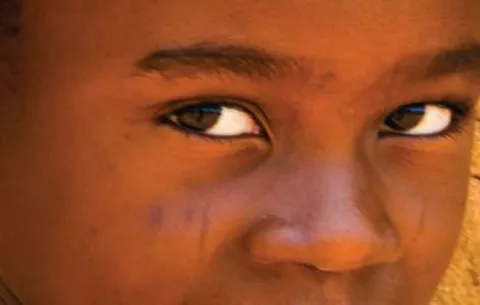 Mutilación genital, sigue siendo un factor de estatus social