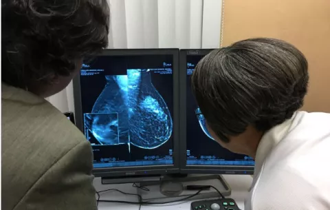 Mamografía 3D en Panamá promete rápidos diagnósticos
