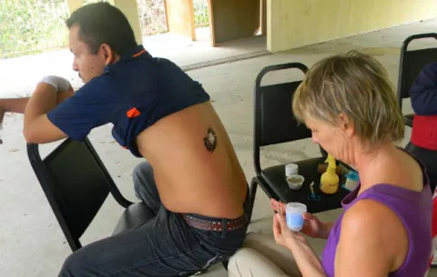 Preocupan nuevos casos de Chagas y Leishmianasis en Panamá Oeste 