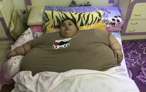 La "mujer más gorda del mundo" pierde 528 libras tras operación