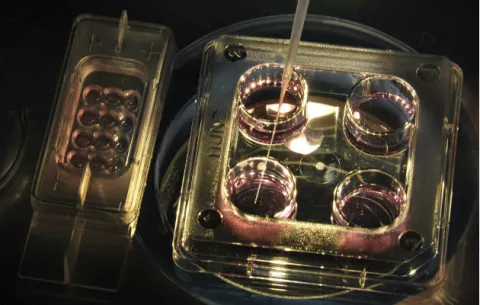 En diez años existirán úteros artificiales, según el investigador Jan Tesarik