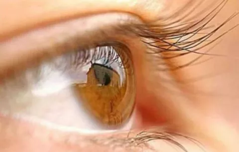Médicos encuentran 27 lentes de contacto en el ojo de una mujer 